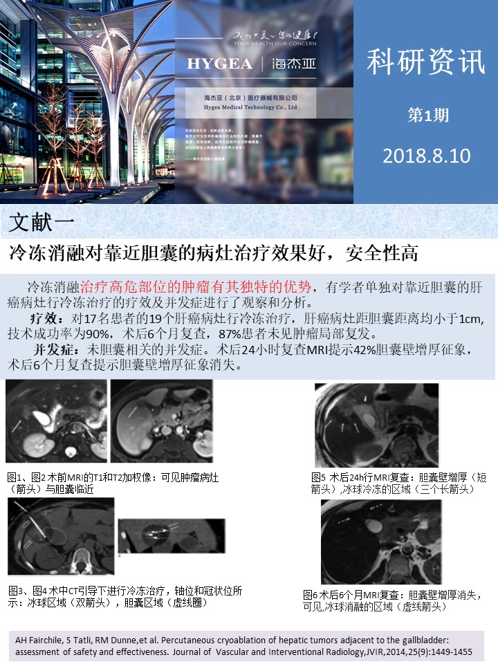 【海杰亞科研資訊】第1期——肝、肺癌消融